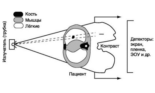 Схема формирования рентгеновского изображения в зависимости от плотности тканей